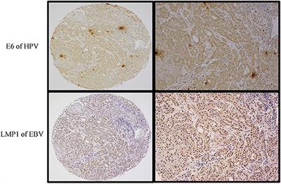 hpv impfung erwachsene krankenkasse